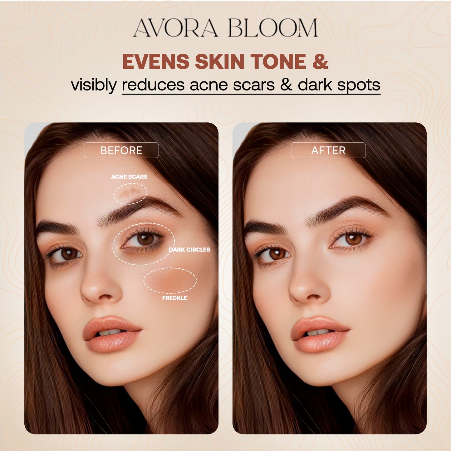 Avora Beauty Balm
